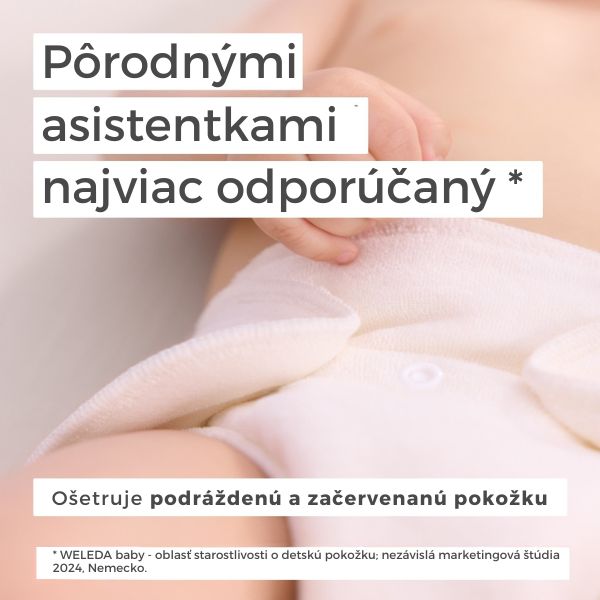Weleda Nechtíkový dojčenský krém na zapareniny je najviac odporúčaný pôrodnými asistentkami Bábätko a informácia, že pôrodné asistentky odporúčajú Weleda Nechtíkový dojčenský krém na zapareniny