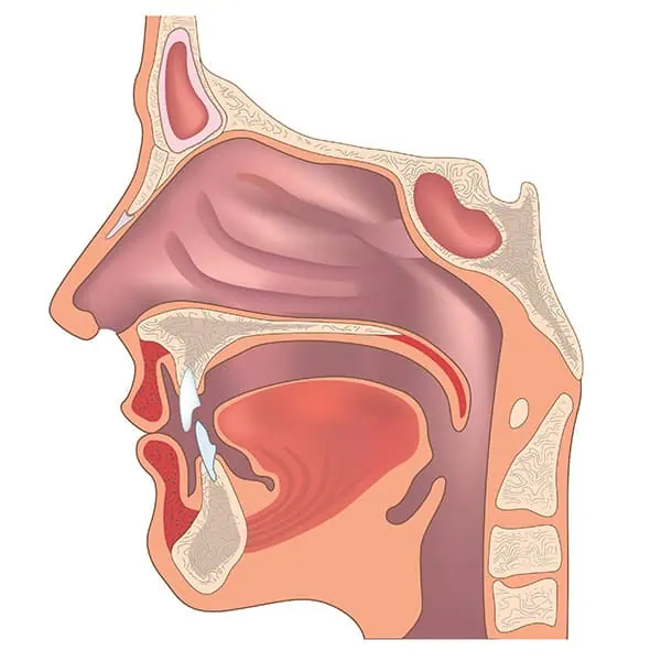 Olynth spôsobuje stiahnutie cievok prítomných v nosovej sliznici a zmiernenie opuchu