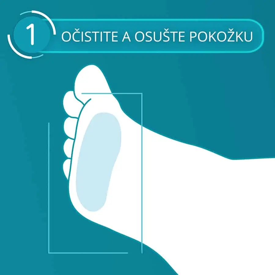 Compeed náplasť na pľuzgiere Sports Underfoot - krok 1