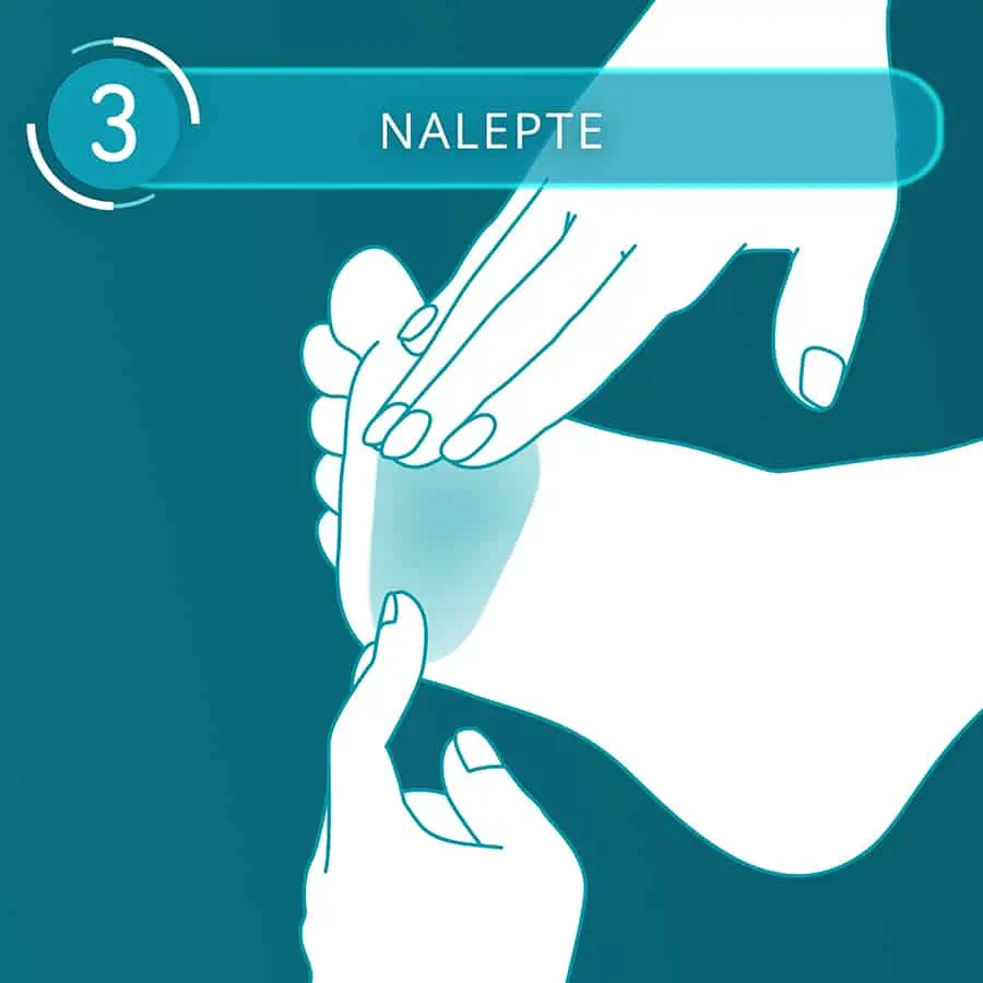 Compeed náplasť na pľuzgiere Sports Underfoot - krok 3