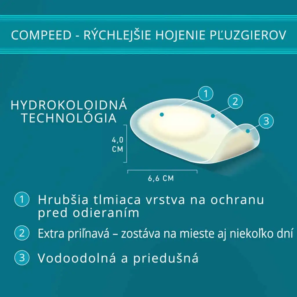 Hydrokoloidná technológia Compeed ponúka lepšie hojenie pľuzgierov nielen v športovej obuvi