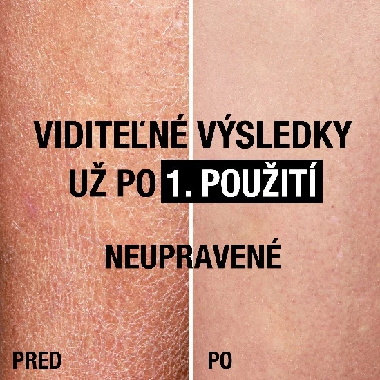 Viditeľné výsledky už po prvom použití