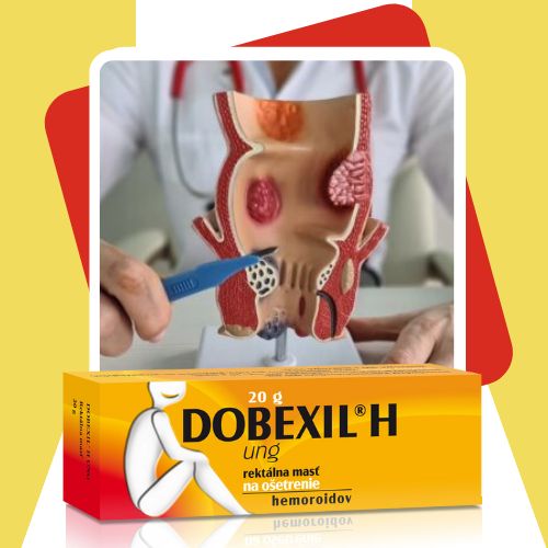 Ako vznikajú v konečníku hemoroidy a na čo je masť Dobexil H určená